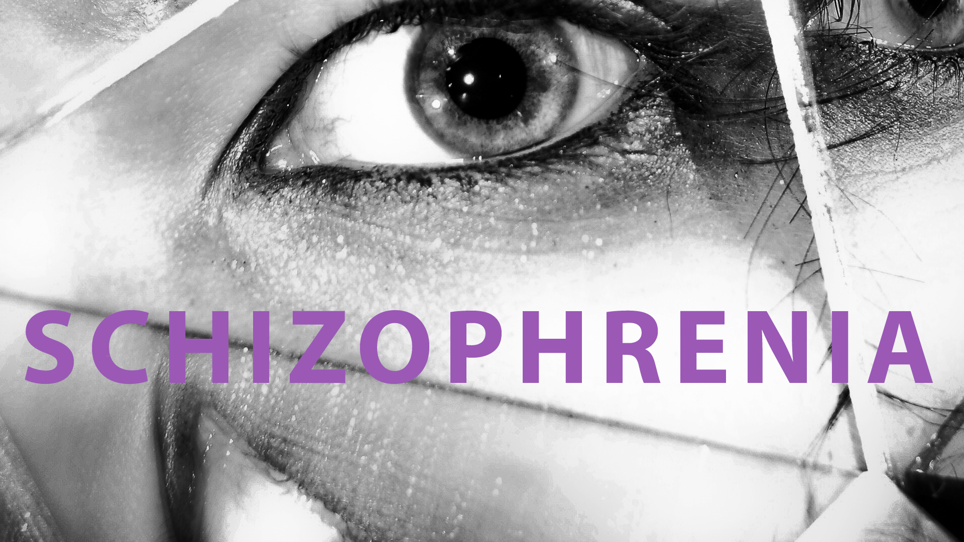 Case studies on schizophrenia paranoid